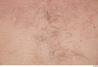 Louis hairy nude skin 0001.jpg